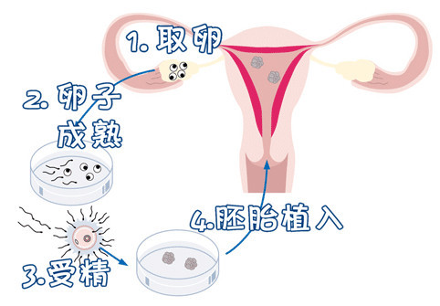 冷冻存储